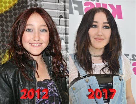 noah cyrus before after|@